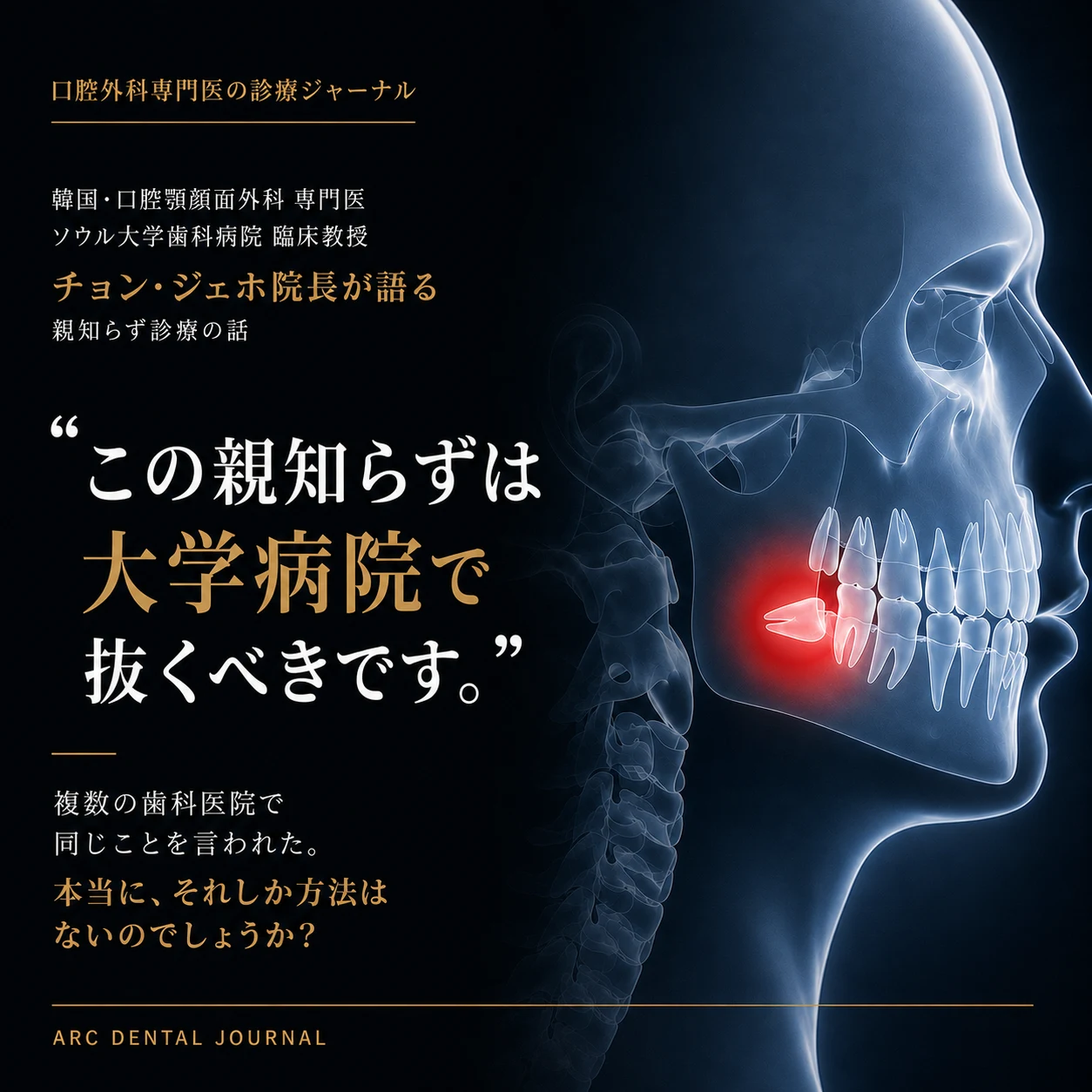 親知らず抜歯で大学病院を勧められたら、本当に大学病院へ行くべきですか?