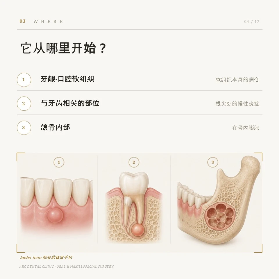 它从哪里开始?