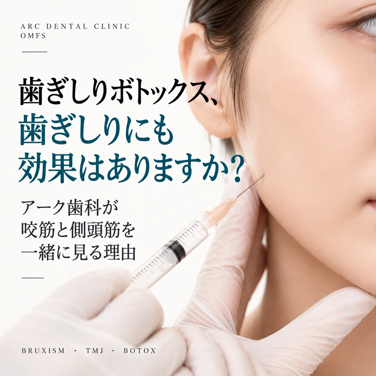 光化門の歯ぎしりボトックス、歯ぎしりにも効果はあるのでしょうか?ARC歯科が咬筋と側頭筋を一緒に診る理由