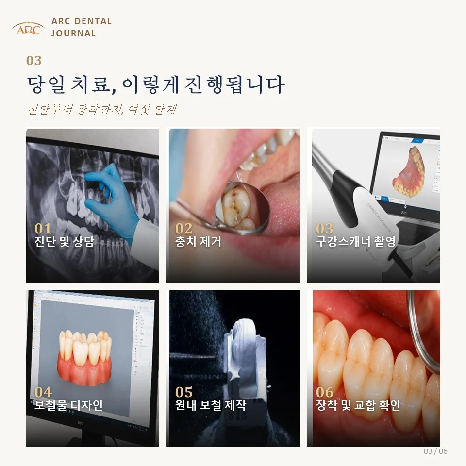 당일 치료, 이렇게 진행됩니다