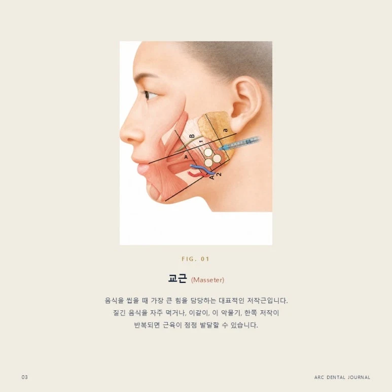 교근(Masseter)