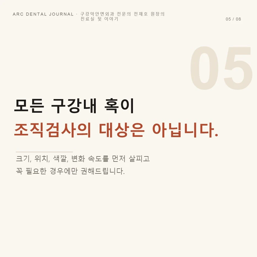 모든 구강내 혹이 조직검사의 대상은 아닙니다