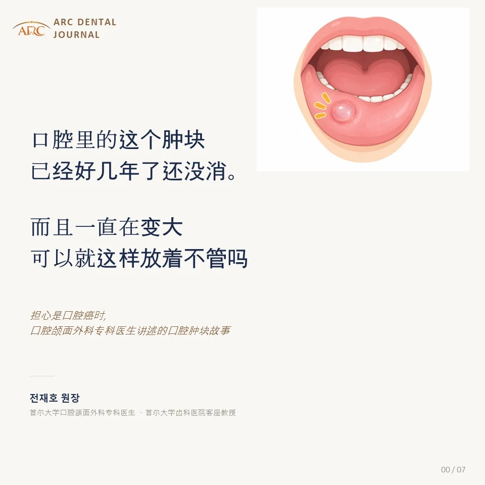 口腔里的肿块已经好几年了还没消,而且还在变大