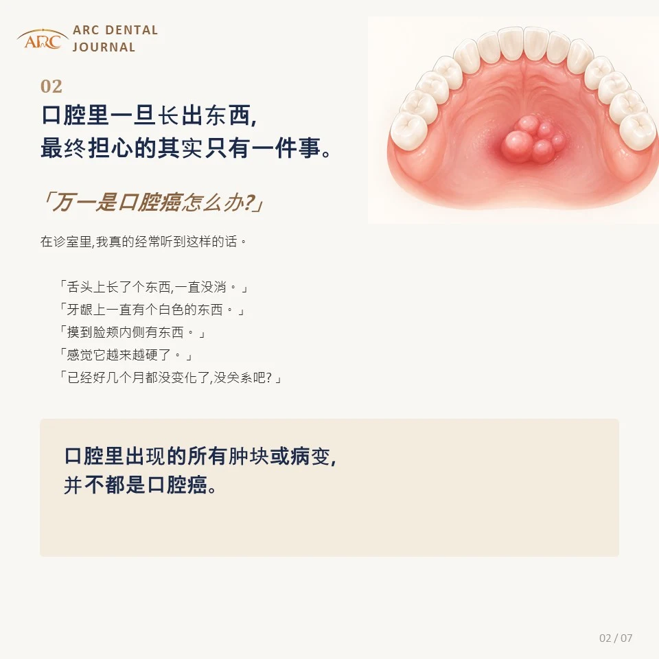口腔里一旦长出东西,最担心的就是万一是口腔癌