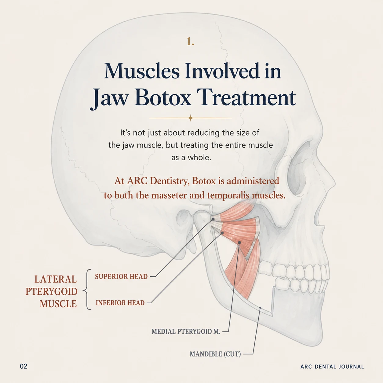 Muscles involved in jaw Botox treatment - lateral pterygoid, medial pterygoid, mandible