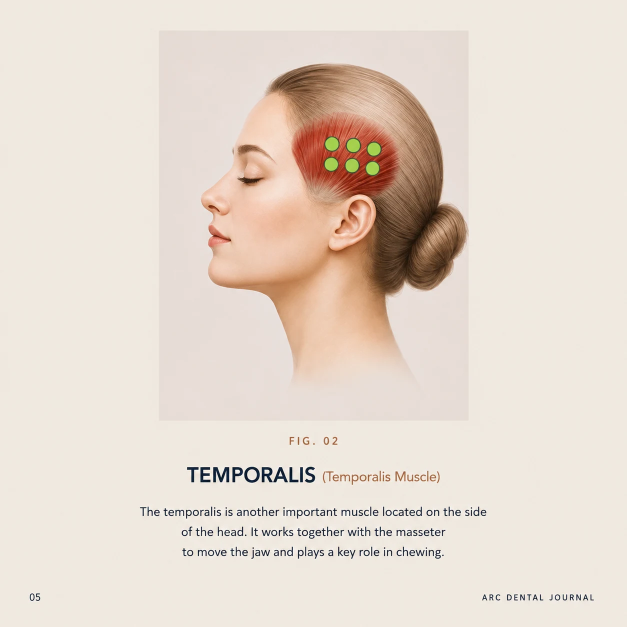 Temporalis muscle - an important chewing muscle located at the temples