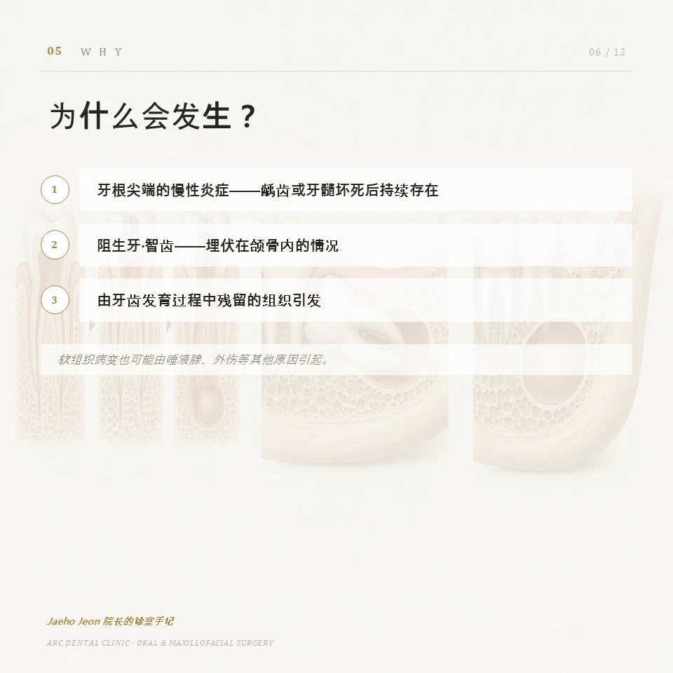 为什么会发生?