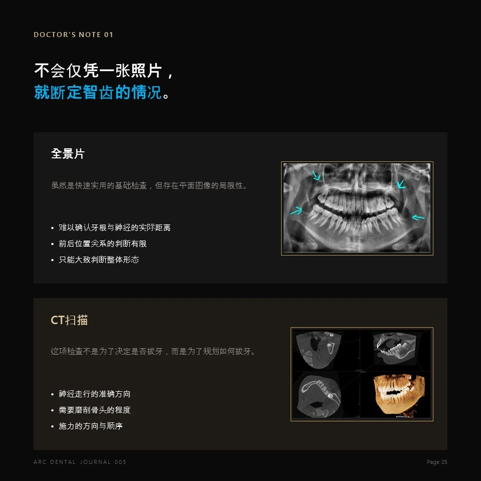 医生笔记 01 - 不会仅凭一张照片，就断定智齿的情况