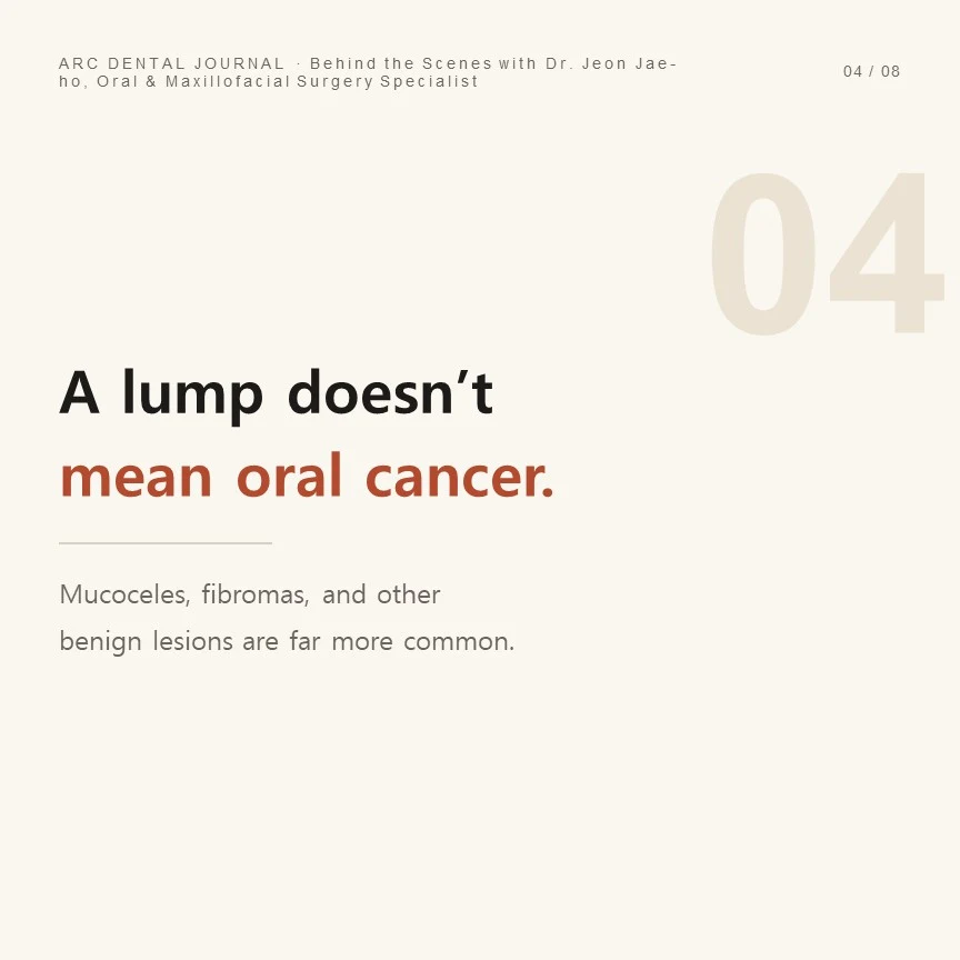 Not every bump in the mouth is oral cancer