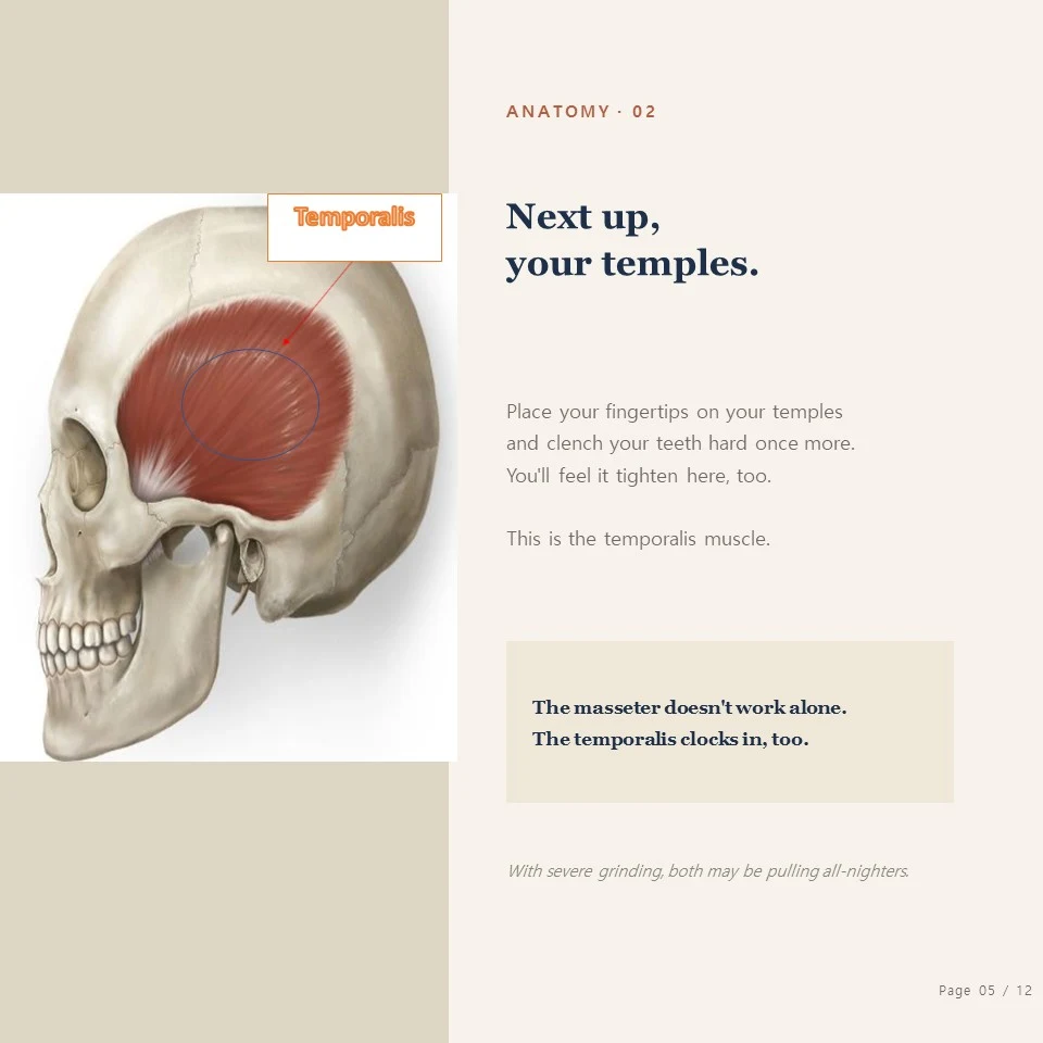 Jongno bruxism botox - the temporalis muscle at your temples Jongno bruxism botox - place your fingers on your temples and feel the temporalis muscle tighten too