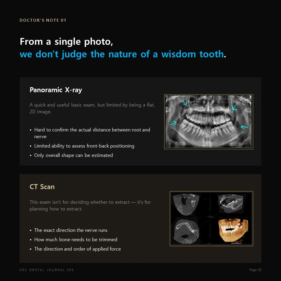 Doctor's Note 01 - From a single photo, we don't judge the nature of a wisdom tooth