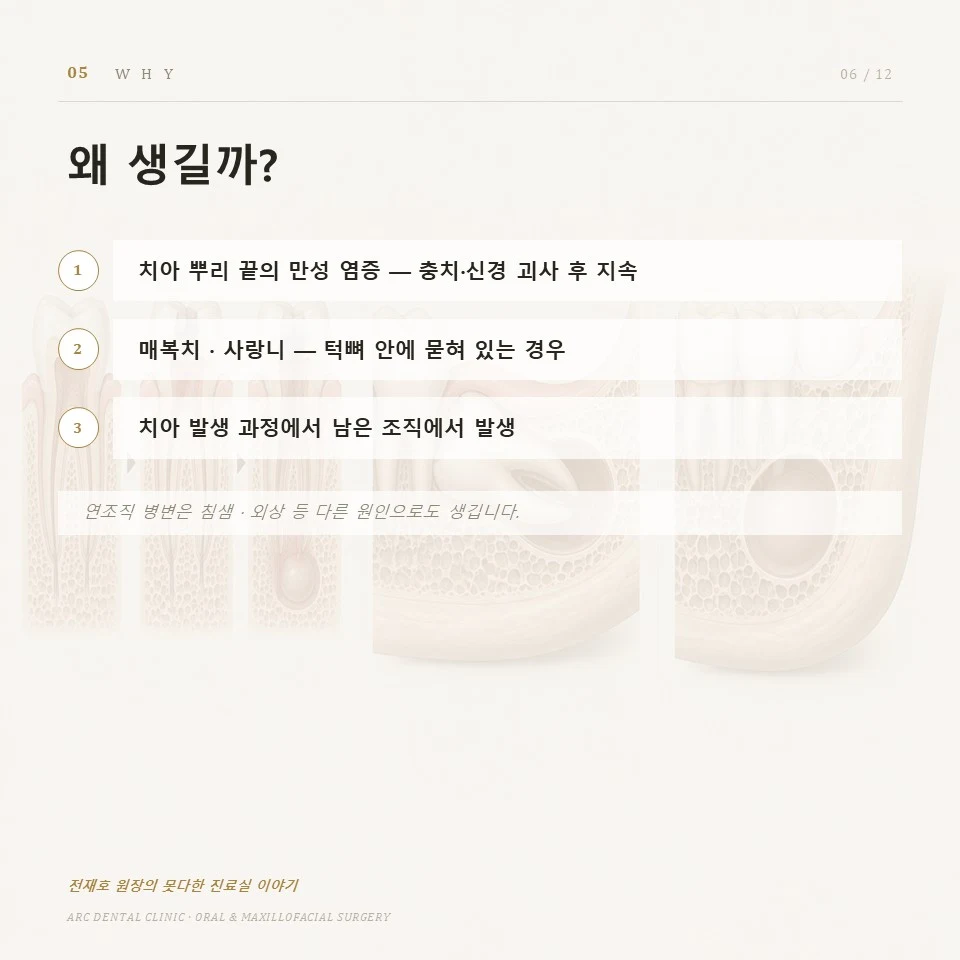 왜 생길까?