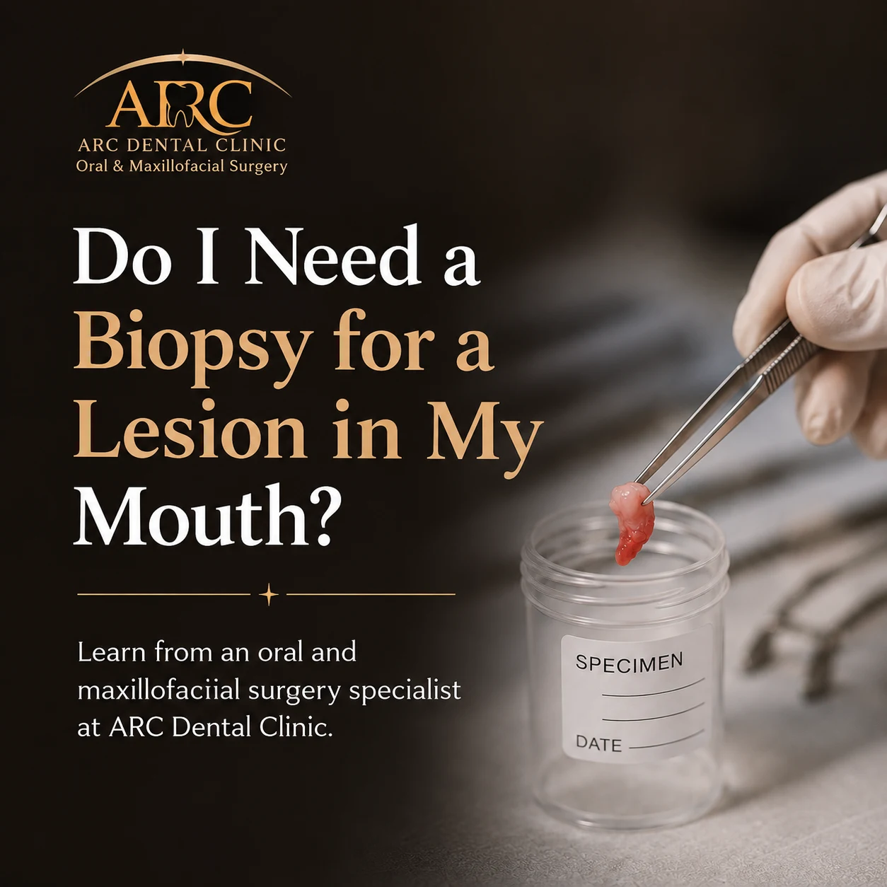 Oral Biopsy: When Is It Really Needed? | Oral & Maxillofacial Surgeon | ARC Dental Clinic
