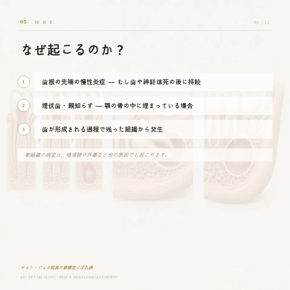 なぜ起こるのか?