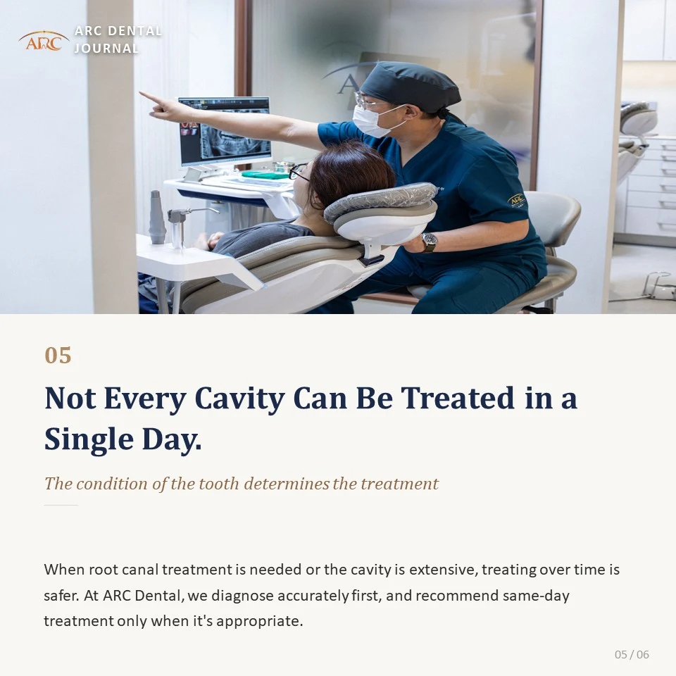 Not every cavity can be treated in one day