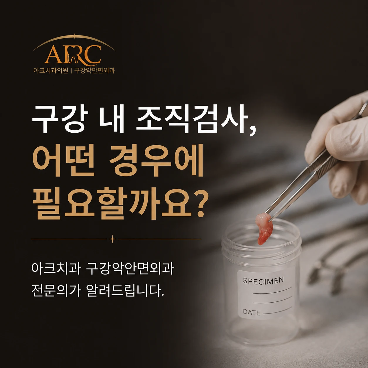 구강 내 조직검사, 어떤 경우에 필요할까요?