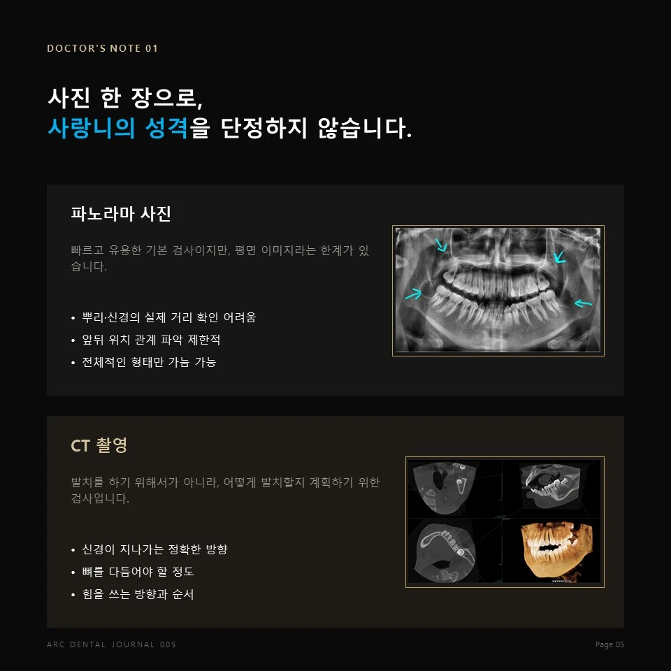 구강악안면외과 사랑니 CT 판독