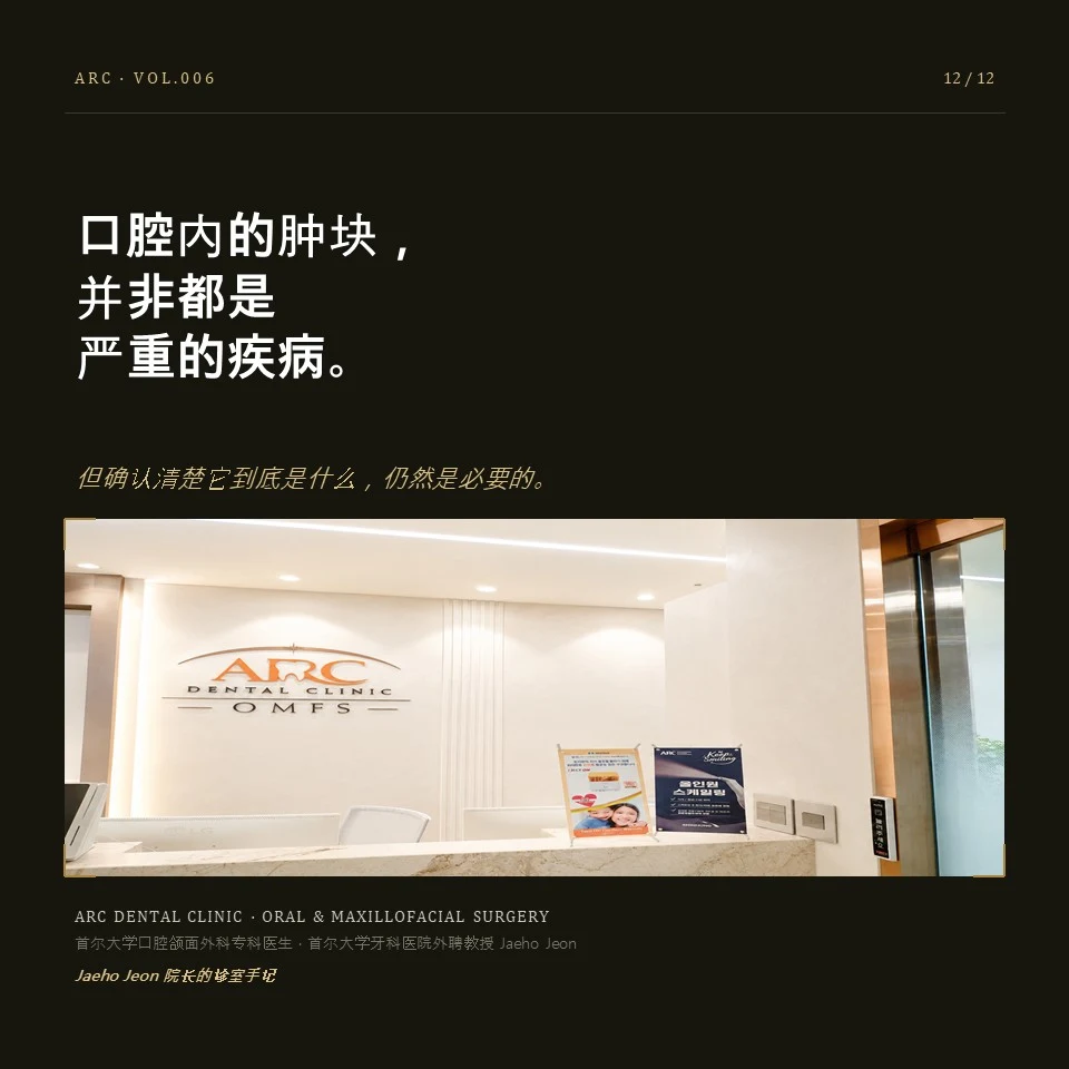 口腔内的肿块,并非都是严重的疾病