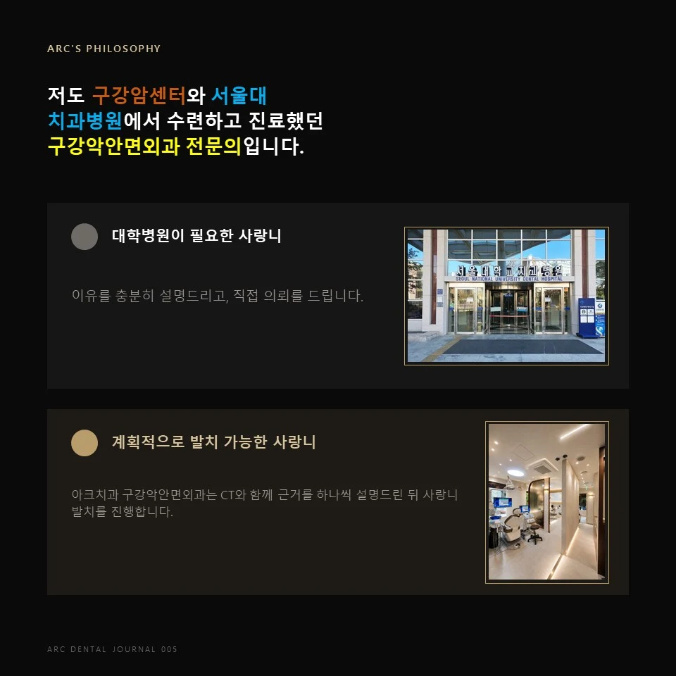 구강악안면외과 전문의 사랑니 발치 상담