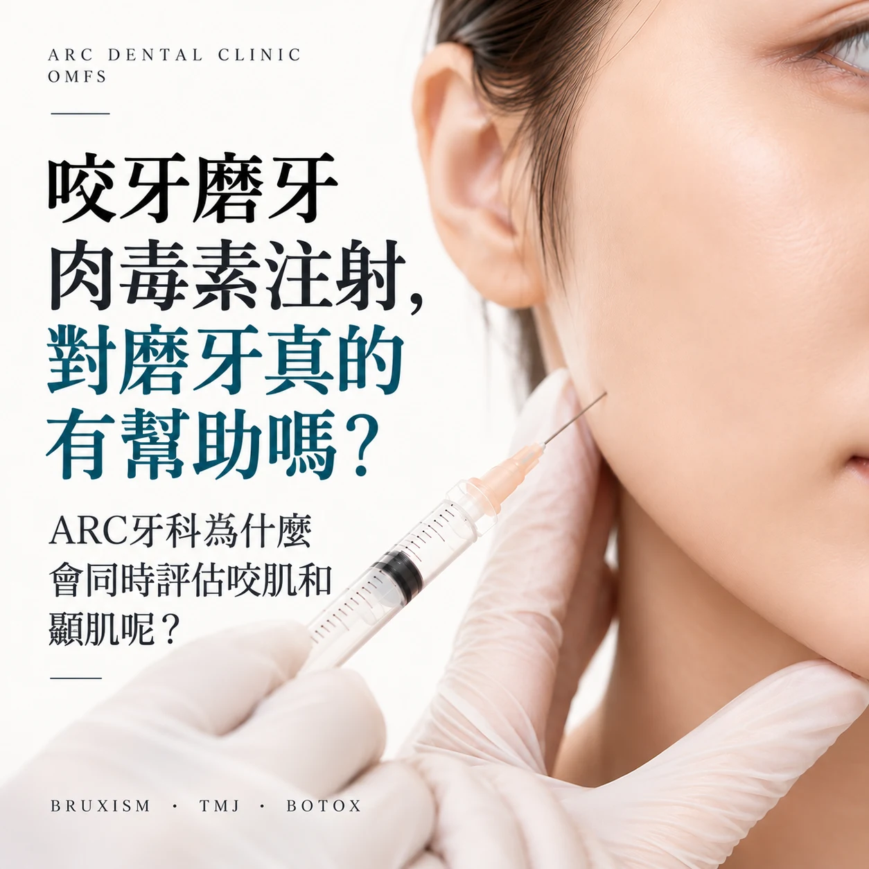 光化门磨牙肉毒素:磨牙肉毒素真的有用吗?ARC牙科为何同时治疗咬肌与颞肌