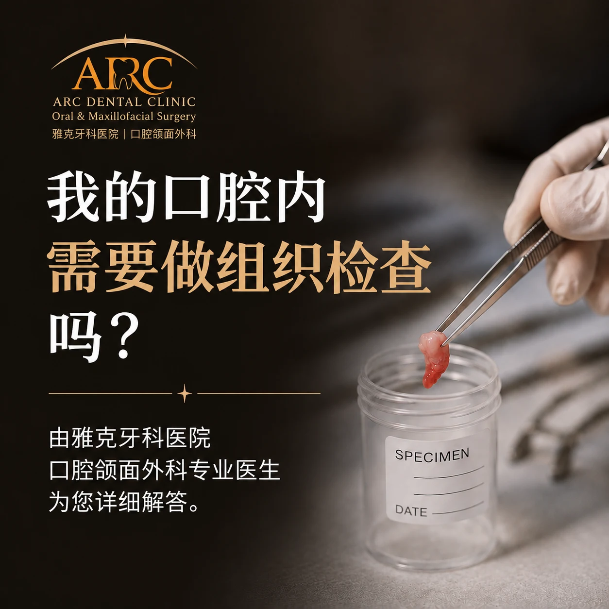 口腔内组织活检,什么情况下才需要? | 口腔颌面外科专家 | ARC牙科诊所
