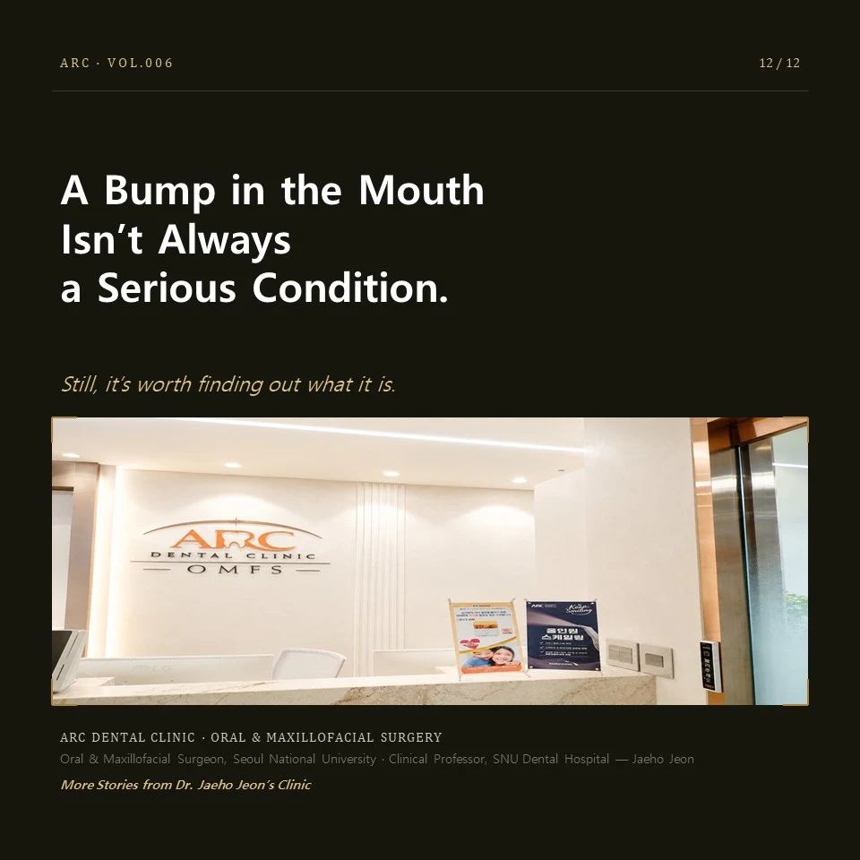 A Bump in the Mouth Isn't Always a Serious Condition