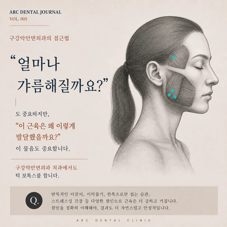 구강악안면외과 턱보톡스 접근법
