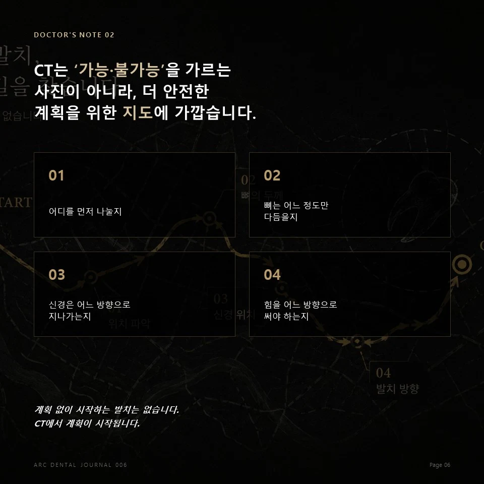 사랑니 발치 CT 기반 진단 계획