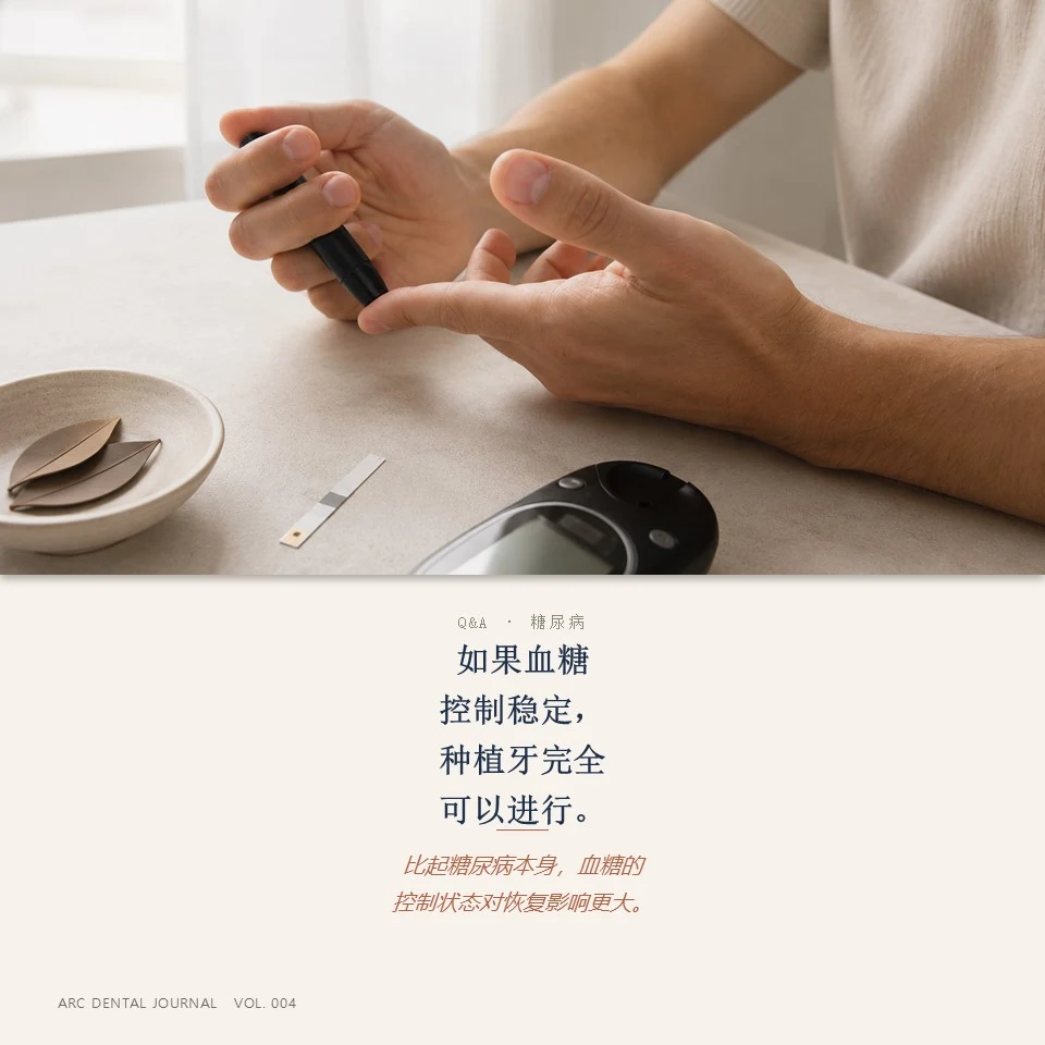 ARC牙科种植牙