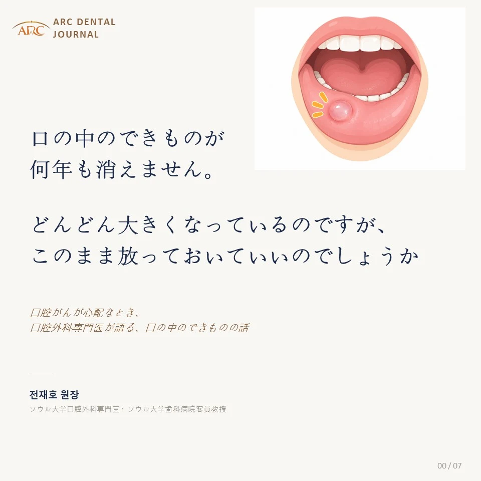 口の中のできものが何年も消えない、どんどん大きくなるとき