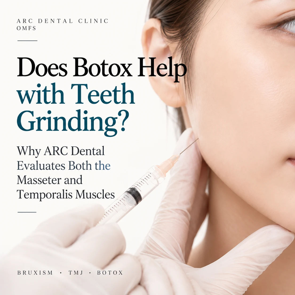 Gwanghwamun Bruxism Botox: Can Botox Really Help Teeth Grinding? Why ARC Dental Treats the Masseter and Temporalis Together