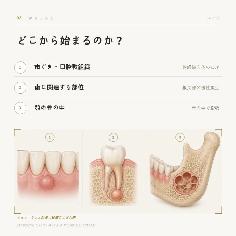 どこから始まるのか?