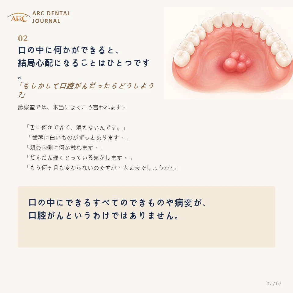 口の中に何かができたときにまず浮かぶ心配
