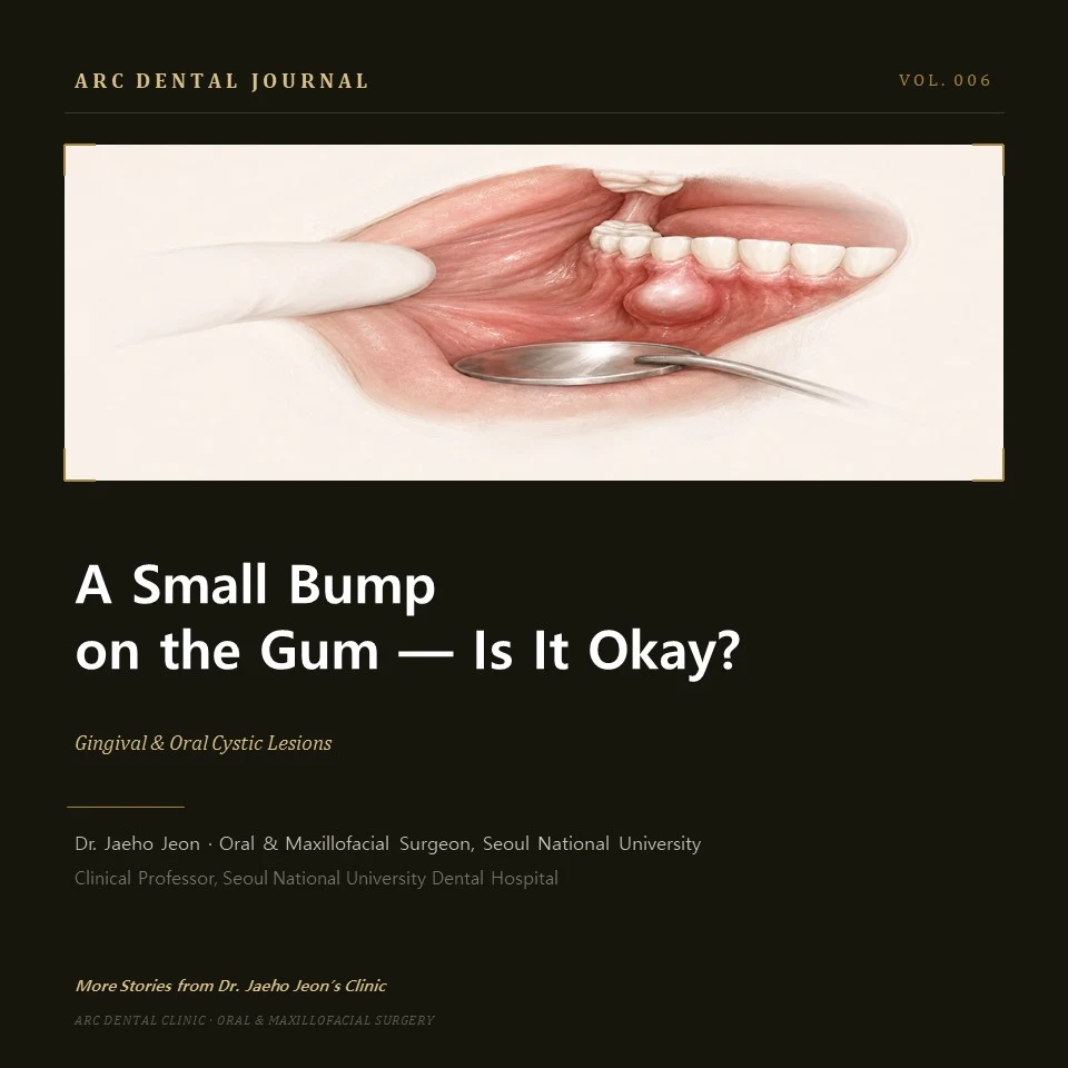 A Small Bump on the Gum - Is It Okay?