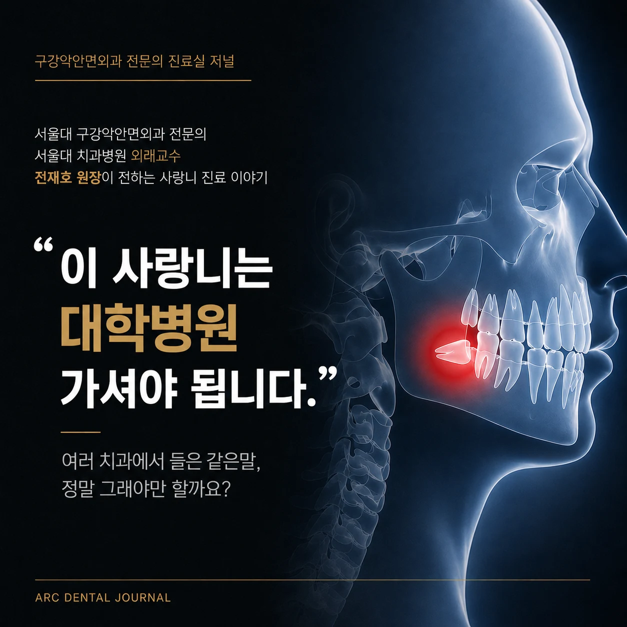 대학병원을 권유받은 사랑니발치, 정말 대학병원까지 가야할까요?