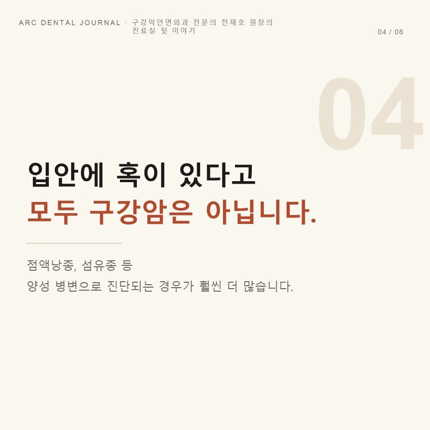 입안에 혹이 있다고 모두 구강암은 아닙니다
