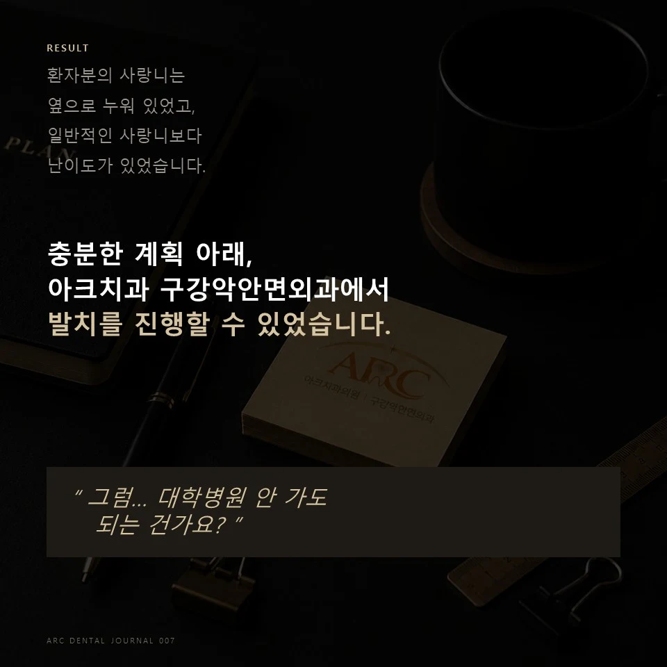 CT로 세우는 사랑니 발치 계획 지도