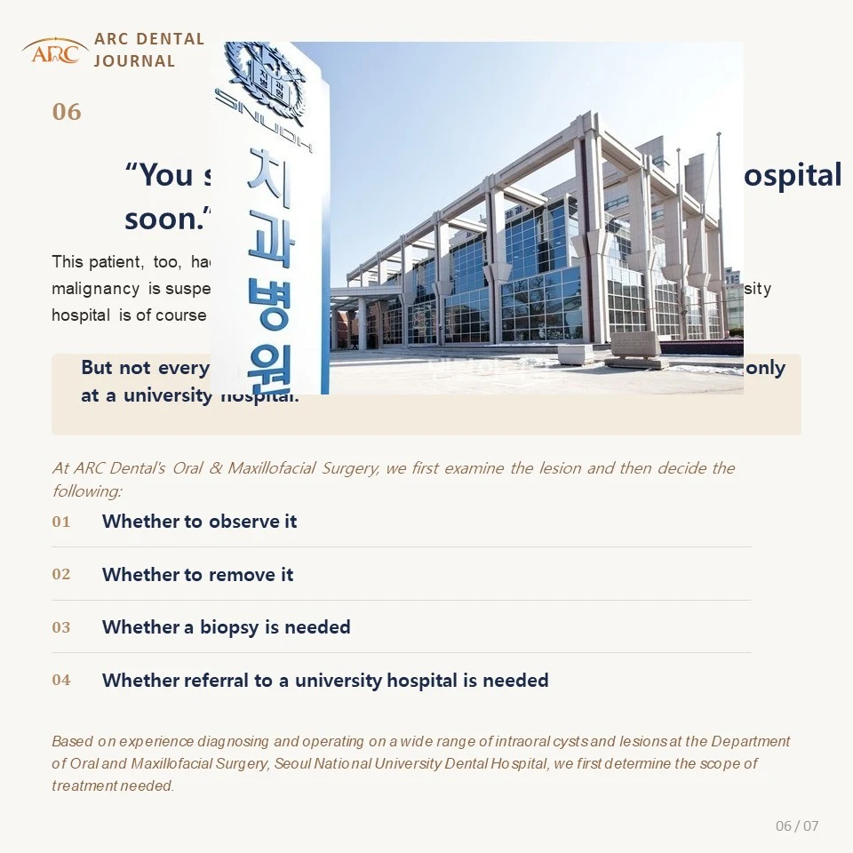 Deciding whether to observe remove biopsy or refer to a university hospital