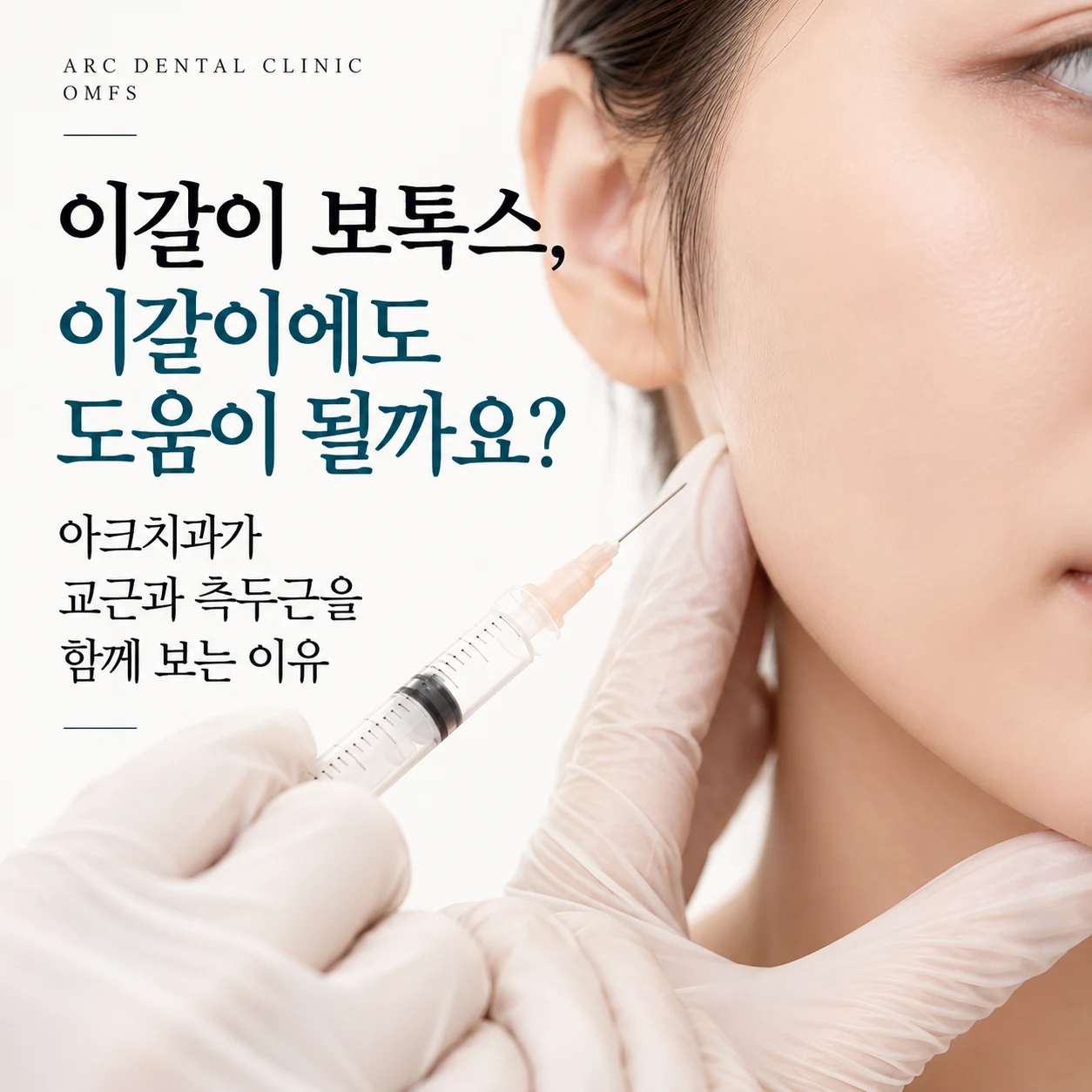 광화문 이갈이 보톡스, 이갈이에도 도움이 될까요? 아크치과가 교근과 측두근을 함께 보는 이유