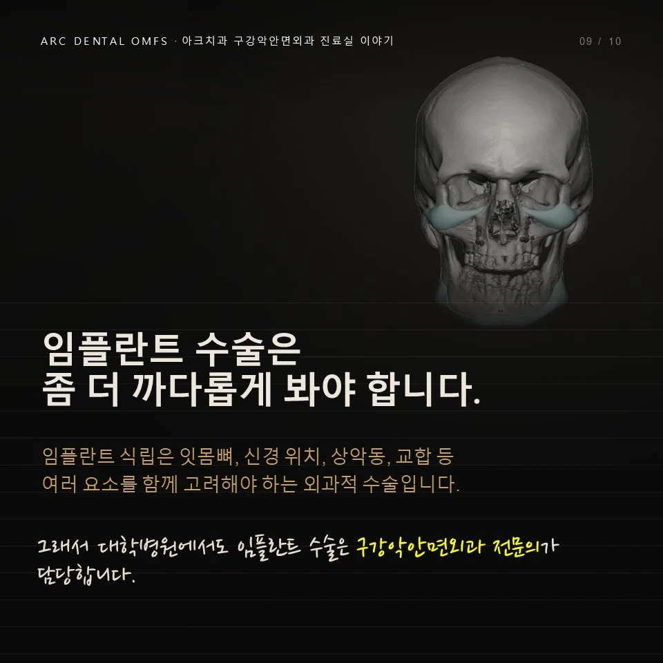 임플란트 수술은 좀 더 까다롭게 봐야 합니다