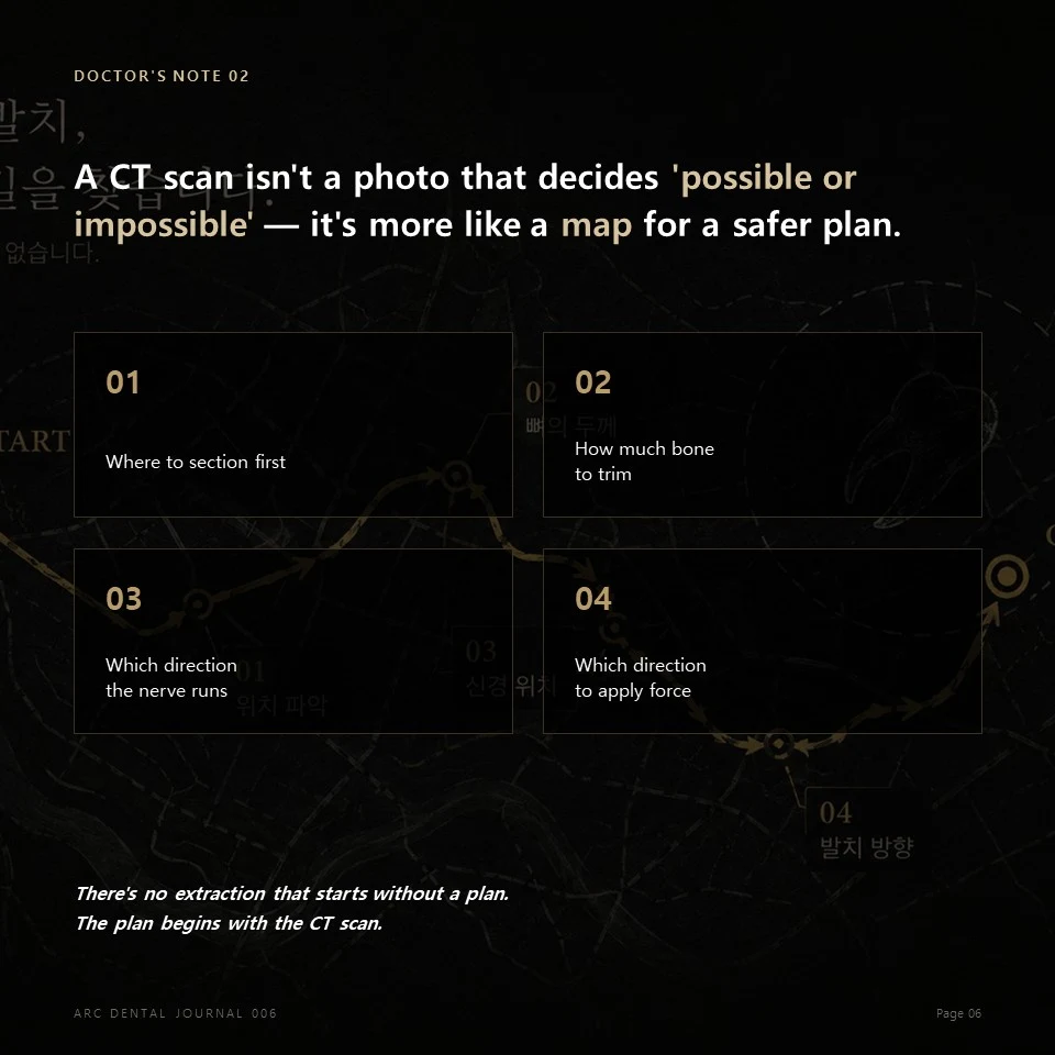 Doctor's Note 02 - A CT scan is a map for a safer extraction plan