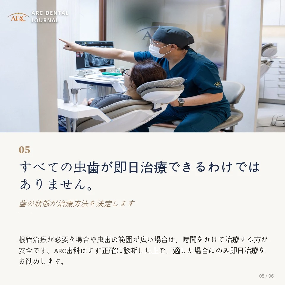 すべての虫歯を1日で治療できるわけではありません
