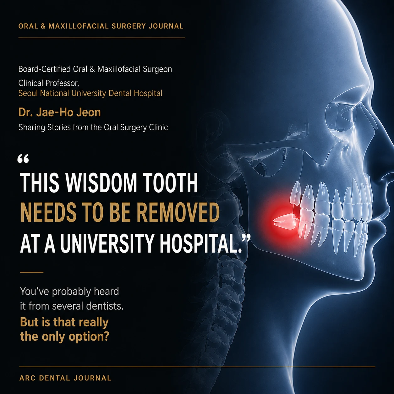 Do You Really Need a University Hospital for Wisdom Tooth Extraction?