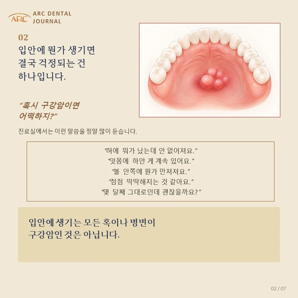 입안에 뭔가 생기면 결국 걱정되는 건 하나입니다 — 혹시 구강암이면 어떡하지
