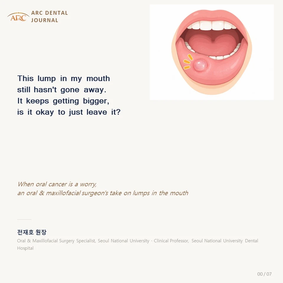 A lump in my mouth that keeps getting bigger