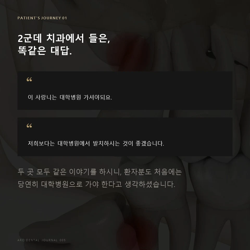 대학병원 사랑니 발치 권유