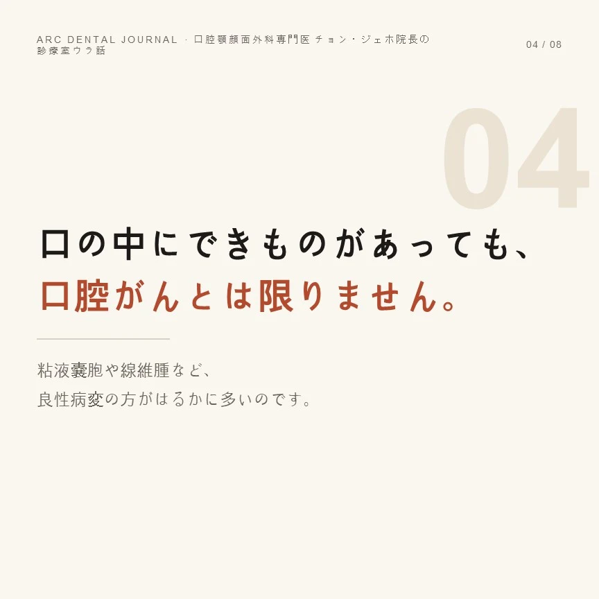 口の中のできものがすべて口腔がんではありません