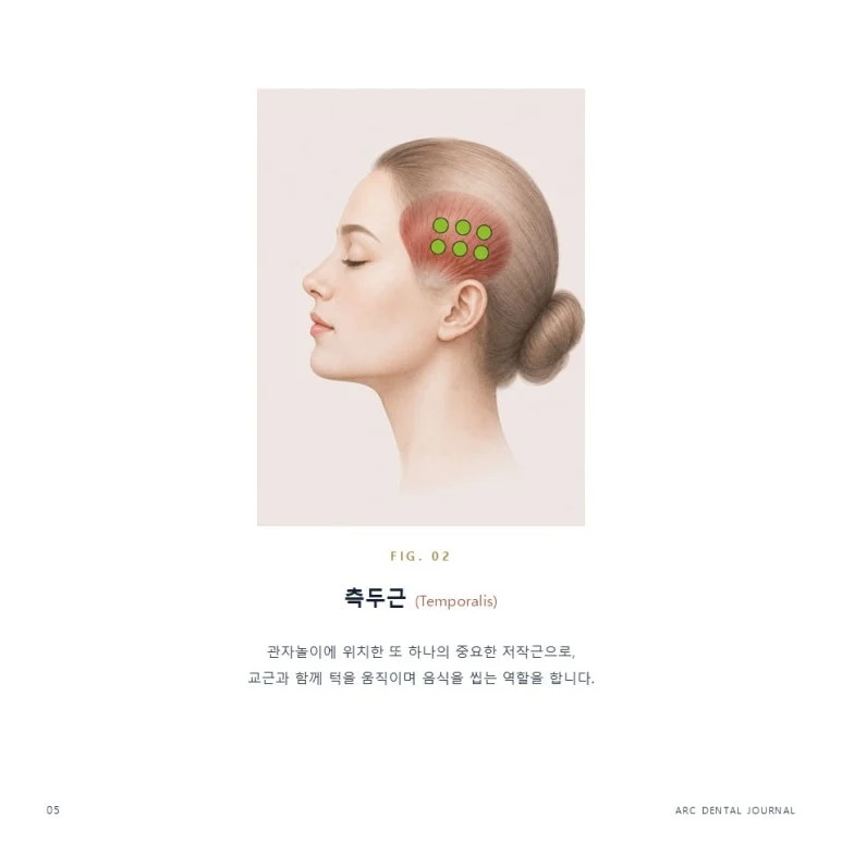 측두근(Temporalis)