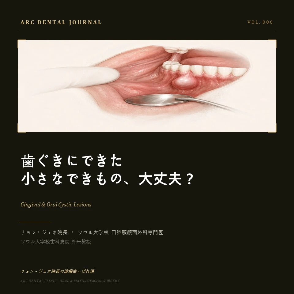 歯ぐきにできた小さなできもの、大丈夫?