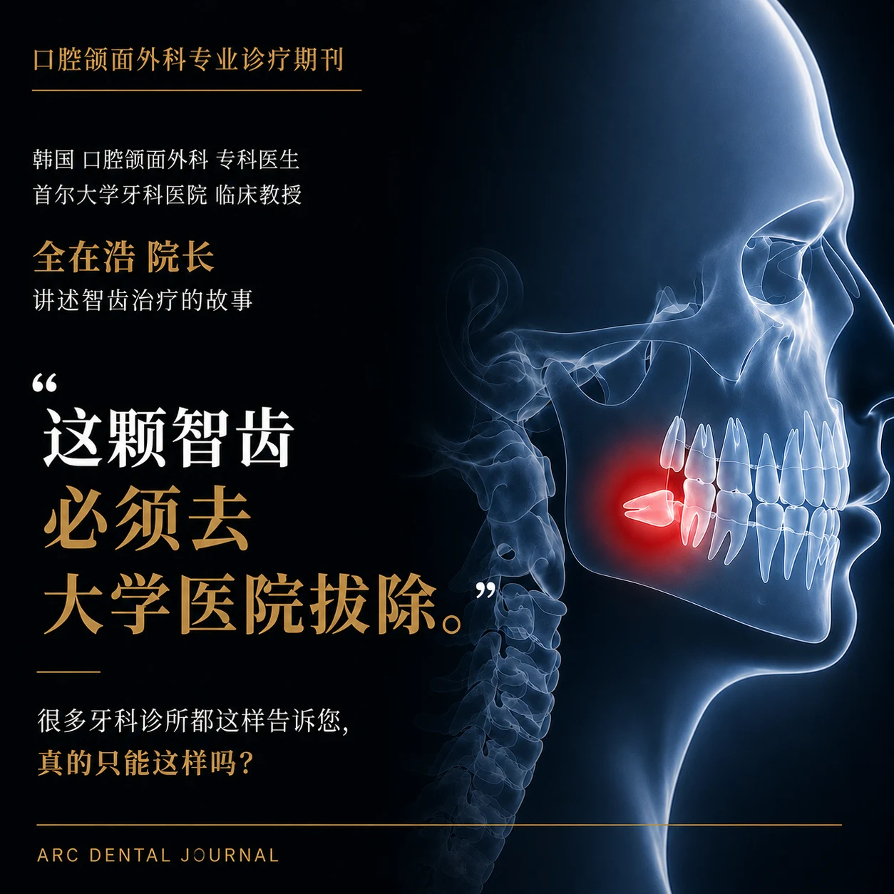被建议去大学医院拔智齿,真的有必要去大学医院吗?